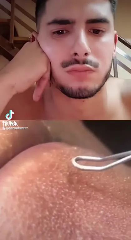 Когда чистка превращается в перекус