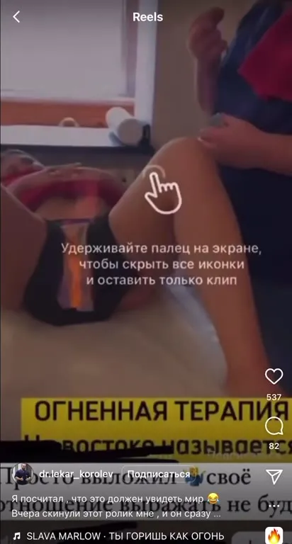 Огненная терапия у врача