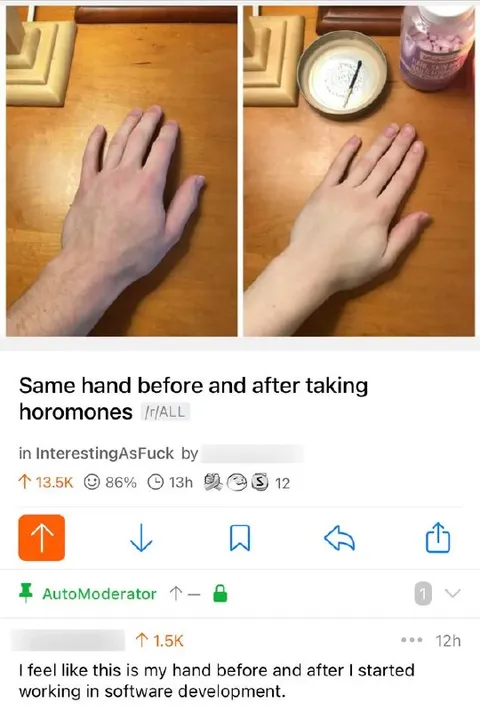Hand Before and After Hormones
