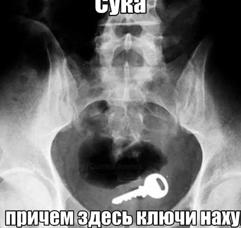 Ключи внутри таза на рентгене