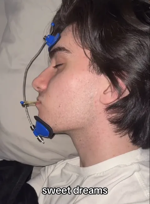 Sweet Dreams With a Mouth Brace