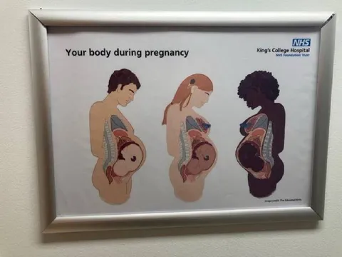 Your Body During Pregnancy
