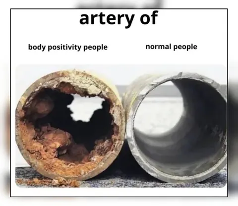 Body Positivity Artery