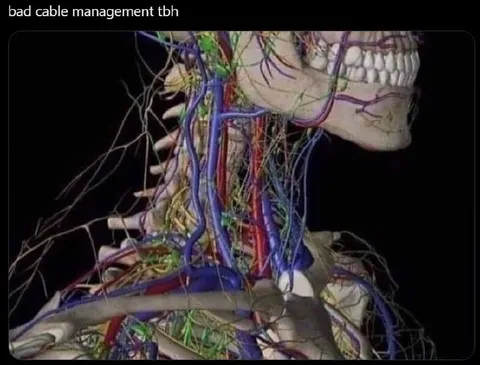 Bad Cable Management Anatomy