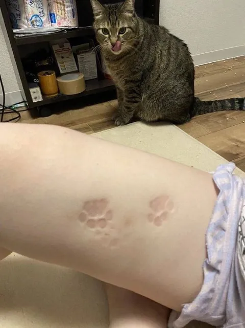 Кошачьи следы на ноге