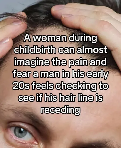 Receding Hairline Anxiety