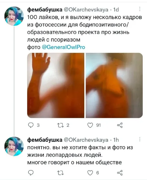 Леопардовые люди и бодипозитив