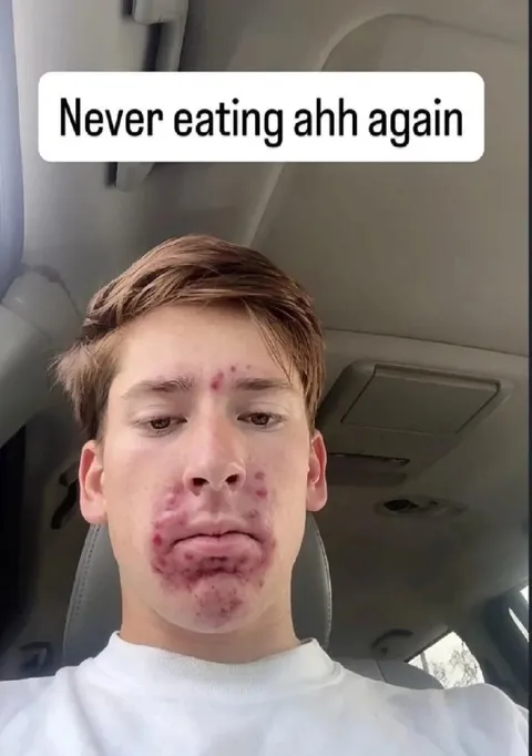 Never Eating Again