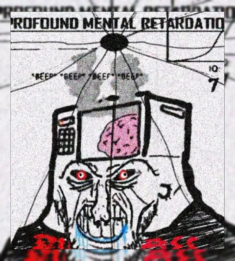Beer-Fueled Mental Retardation