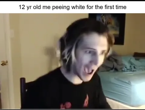 12-Year-Old Peeling White
