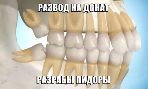Развод на донат у стоматолога