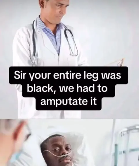 Doctor Explains the Amputation