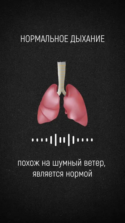 Что врачи слышат в лёгких