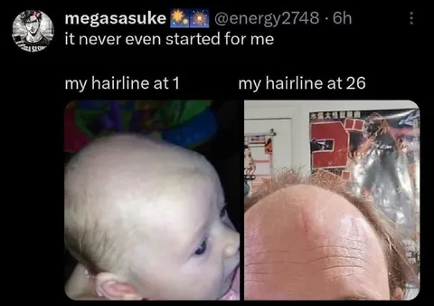 Hairline at One and Twenty-Six