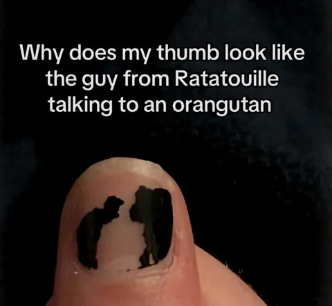 Thumb Looks Like Ratatouille