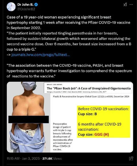 The Pfizer Boob Job Case