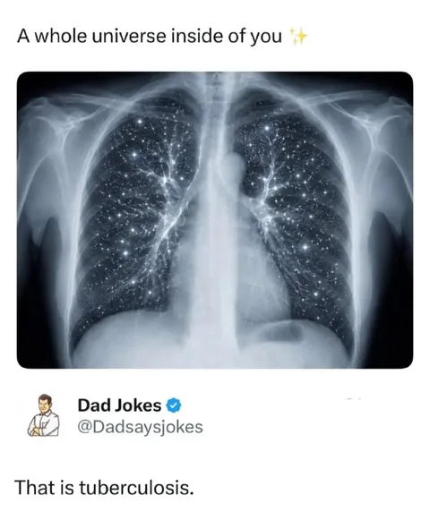 A Universe Inside Your Lungs