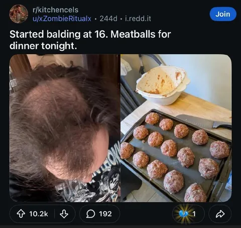 Balding at 16 Meatballs