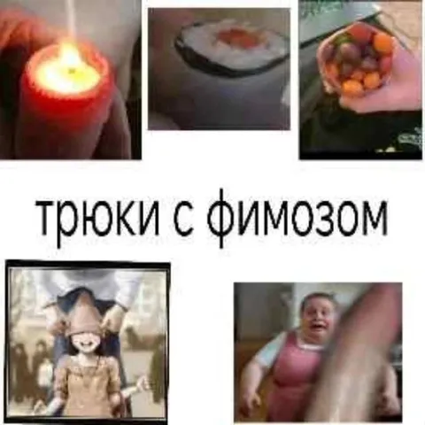 Трюки с фимозом