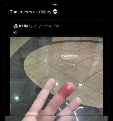 Tom and Jerry Finger Injury