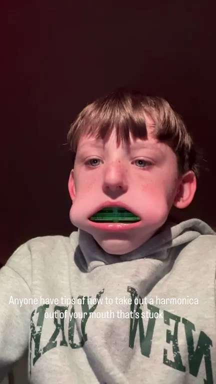 Harmonica Stuck in Mouth