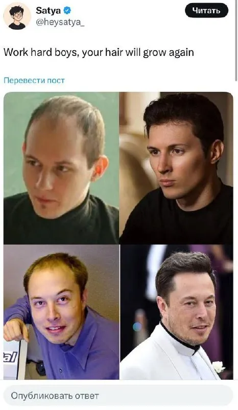 Elon Musk Hair Growth