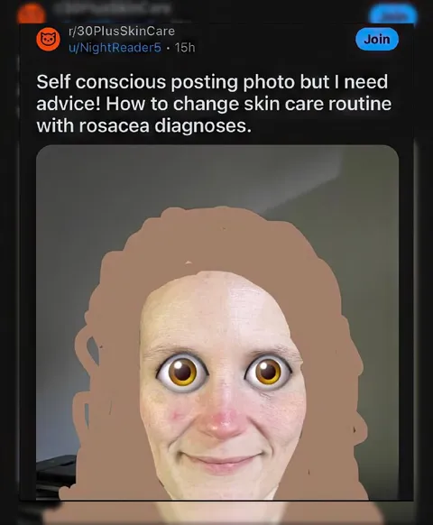Rosacea Skincare Advice