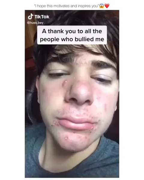 Thank You to My Bullies