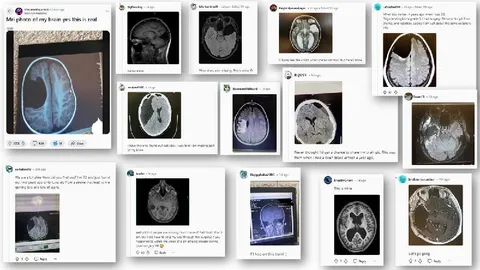 People Sharing Their Brain Scans