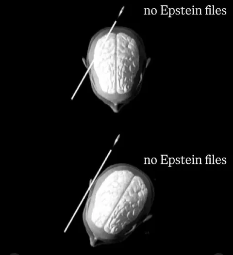 No Epstein Files Brain Scan