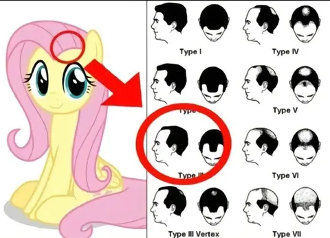 Fluttershy Hair Loss Type