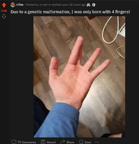 Born With Four Fingers