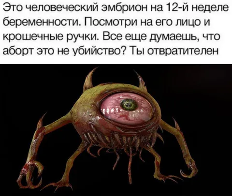 Эмбрион на 12-й неделе