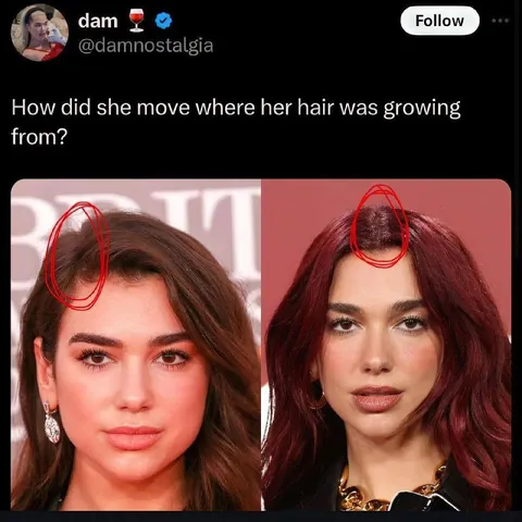 Dua Lipa Hair Part Mystery