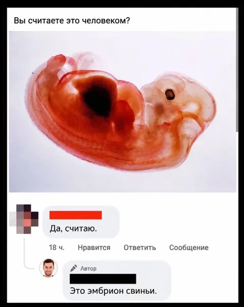 Эмбрион свиньи — это человек?