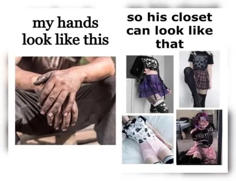 My Hands Look Like This
