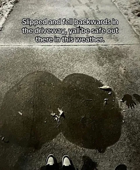 Slipped in the Driveway