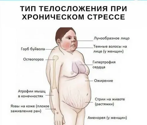 Тип телосложения при хроническом стрессе