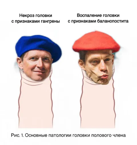 Патологии головки полового члена