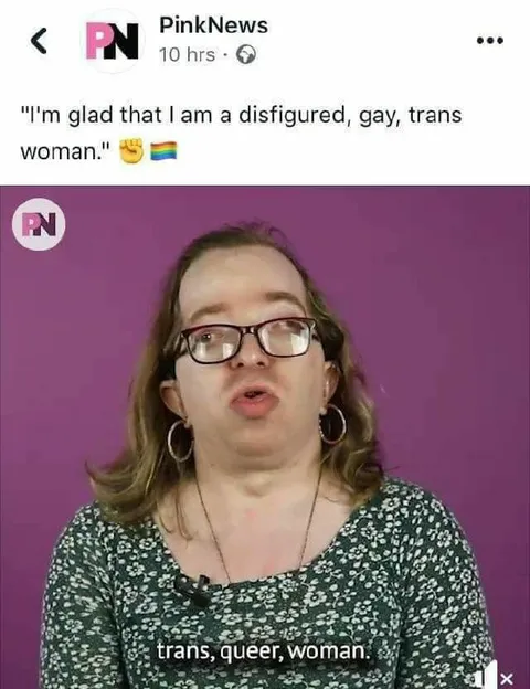 Disfigured Gay Trans Woman