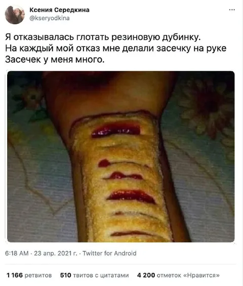 Засечки на руке