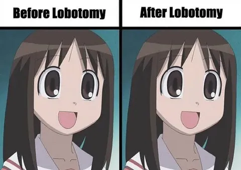 Before and After Lobotomy