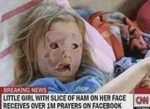 Girl With Ham Face Gets Prayers