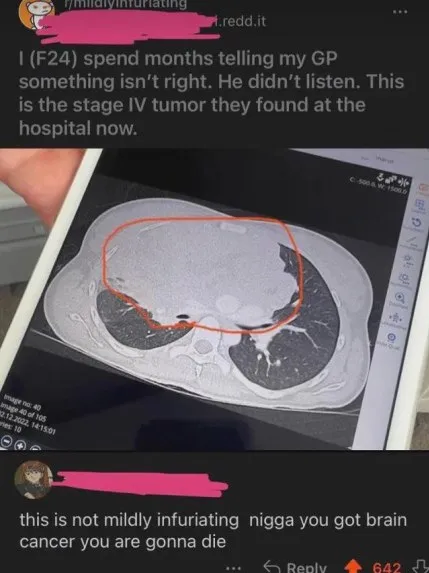 Brain Tumor Is Not Mildly Infuriating