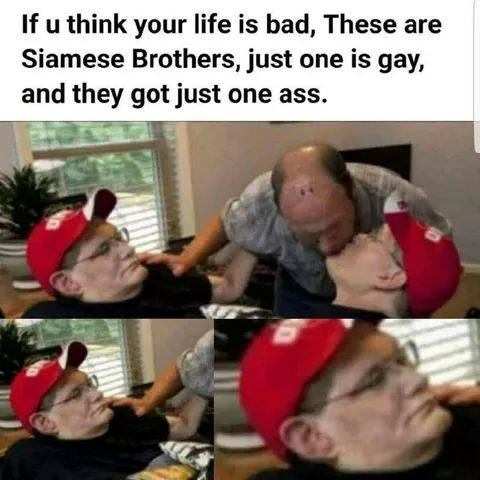 Siamese Brothers Have One Ass