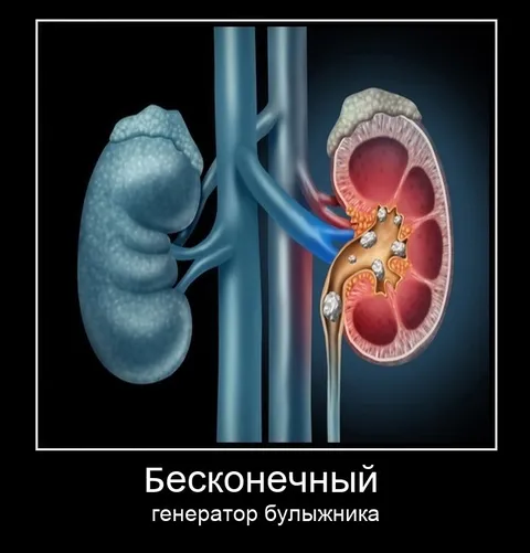 Бесконечный генератор булыжника