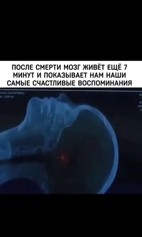 После смерти мозг показывает счастливые моменты