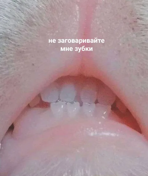 Не заговаривайте мне зубки