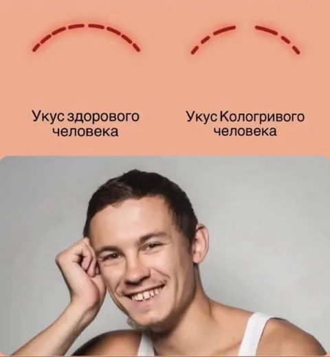 Вкус укуса Кологривого