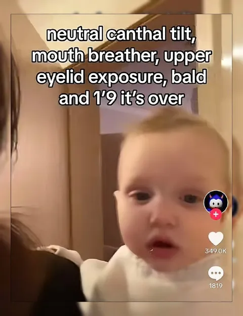 Baby With Unfortunate Features